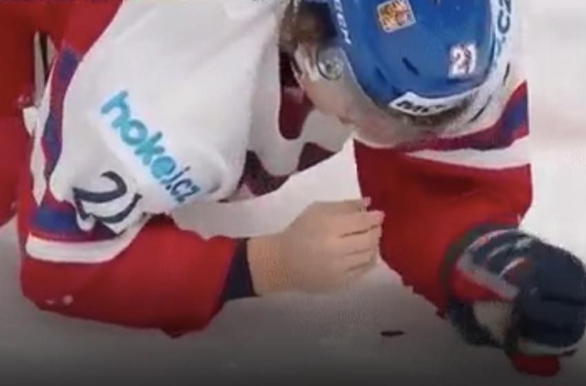 Breaking: Rangers' star prospect headbutted by Russian, leaves the ice bloodied