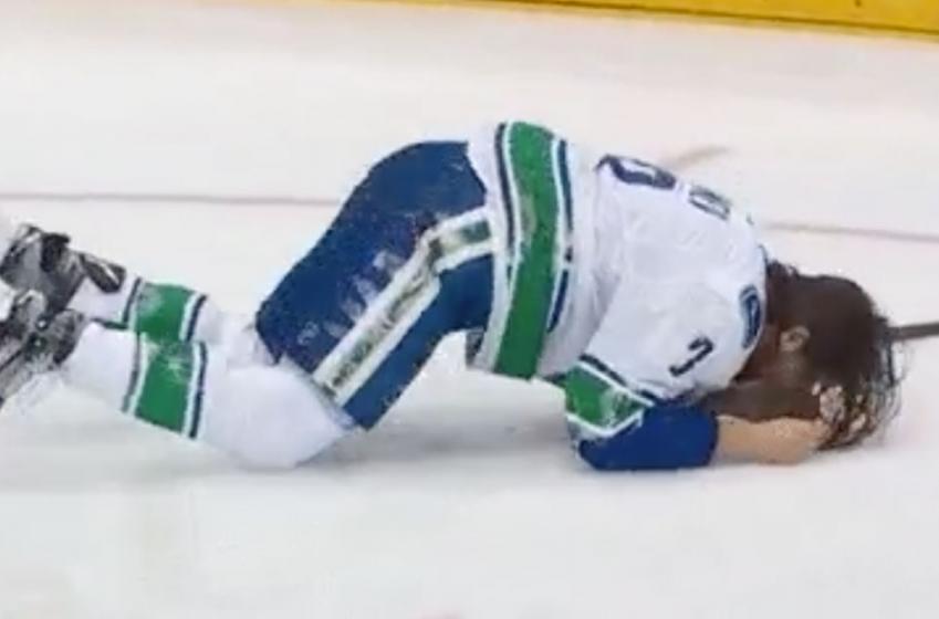 Must see: Tanev takes puck to the face and teeth go flying! 